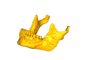 mandibula-stl